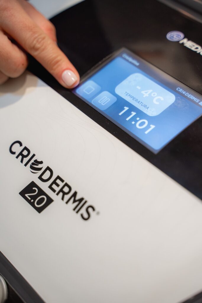 Edlane Bastos aplicando Criolipólise para congelamento de gordura no RJ