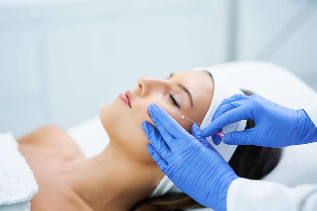 Fios Aptos para flacidez facial aplicados por dermatologista no Cachambi, Rio de Janeiro