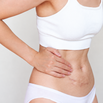 Mulher usando top branco e roupa íntima clara, com a mão apoiada na cintura, destacando a textura natural da pele e marcas corporais em uma fotografia minimalista com iluminação suave.