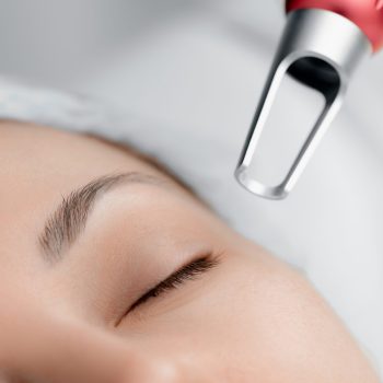 Dermatologista aplicando laser quadri pico para rejuvenescimento em sua paciente no Rio.
